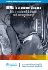 thumbnail of noma info brochure